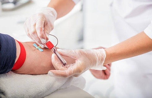 Laboratório para coleta de exames  Ermelino Matar