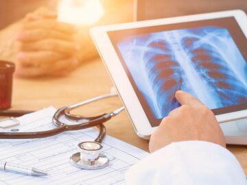 Solicitação de recursos para aquisição de aparelho de digitalização de imagens de RaioX, bem como de equipamentos para a estruturação da sala de radiologia da Santa Casa da Misericórdia de Iacanga.