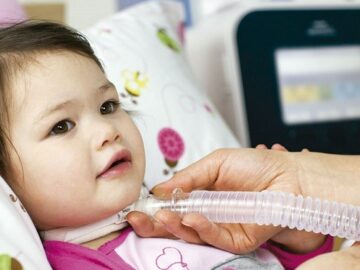 AME  Atrofia Muscular Espinhal  São Roque