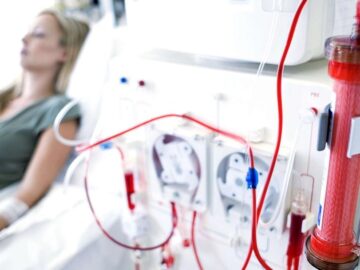 Implementar o procedimento de hemodiálise – São Pedro