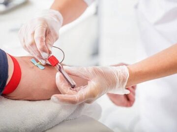 Laboratório para coleta de exames  Ermelino Matar