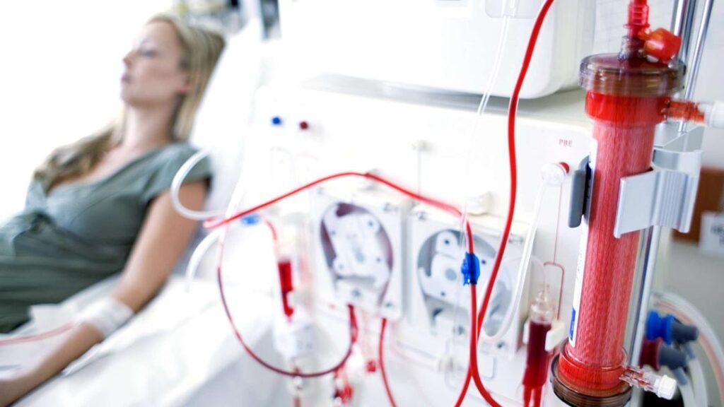 Implementar o procedimento de hemodiálise – São Pedro
