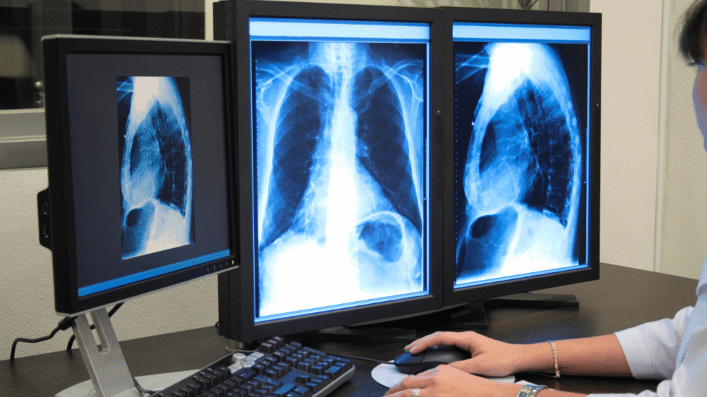 Aparelho de RaioX digital para a Santa Casa de Arealva