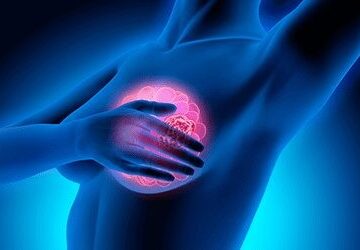 Fortalecimento do setor de Mastologia do Hospital Amaral Carvalho – Jaú