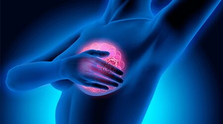 Fortalecimento do setor de Mastologia do Hospital Amaral Carvalho – Jaú