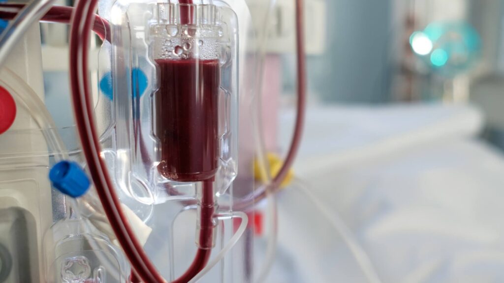 PL 8310/2017 – Isenta do Imposto de Renda as receitas provenientes da prestação de serviços de hemodiálise por hospitais e clínicas privados a pacientes do Sistema Único de Saúde (SUS).