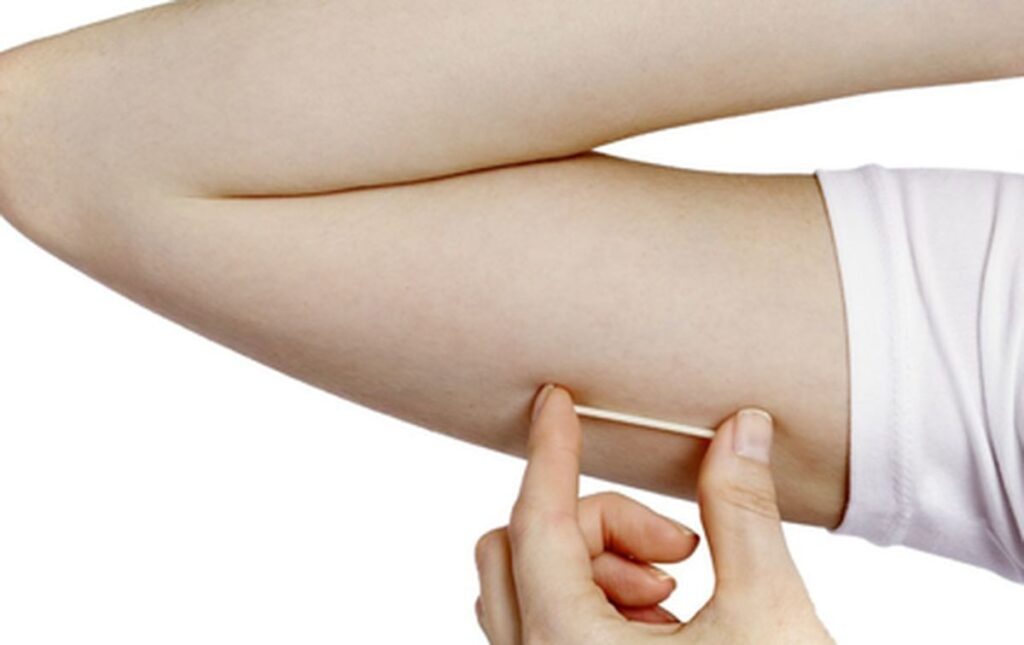PL 2107/2023 – Disponibilização do Implante Subdérmico Contraceptivo