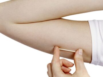 PL 2107/2023 – Disponibilização do Implante Subdérmico Contraceptivo